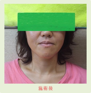 施術後
